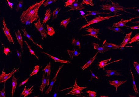 C7 Human foreskin fibroblast on titanium