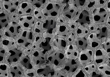 C1 Sección transversal de una estructura porosa de Titanio (SEM)