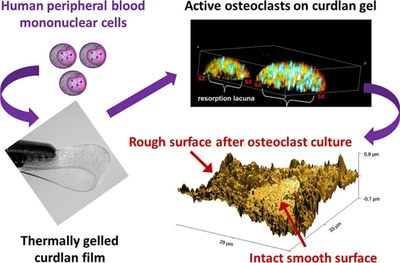 Osteoclast-mediated acidic hydrolysis of thermally gelled curdlan component of the bone scaffolds Is it possible.jpg