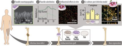 Tailoring nanotopography and antibacterial properties of calcium phosphate bone grafts via fluoride incorporation.JPG