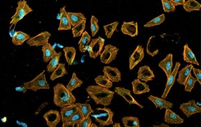 L'equip de transferència de tecnologia aconsegueix finançament per desenvolupar un nou implant porós de titani en col·laboració amb AMES Medical