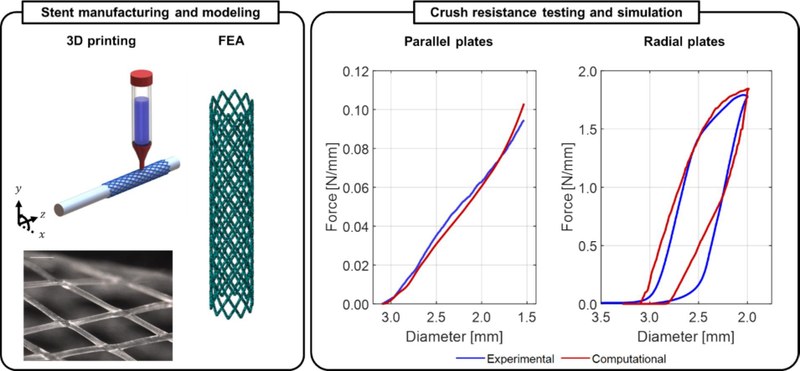 3D printed polymeric stent design Mechanical testing and computational modeling.jpg