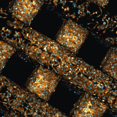 BBT receives funding to carry its research on 3D printing of calcium phosphates for bone regeneration