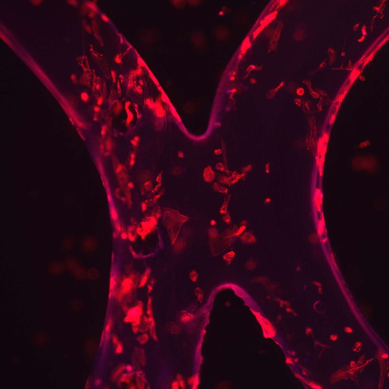 Marta Pegueroles receives CaixaImpulse funding to develop new pediatric aortic stents