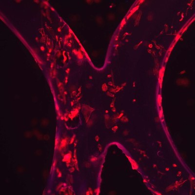 Marta Pegueroles receives CaixaImpulse funding to develop new pediatric aortic stents