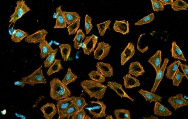 Tech Transfer team secures funding for developing a new porous titanium implant in collaboration with AMES Medical.