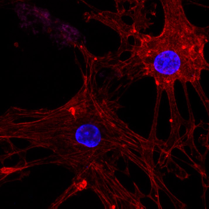 C1-Rat endothelial progenitor cells on beta tricalciumphosphate.jpg