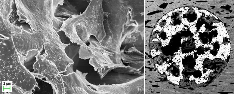 Porous Titanium