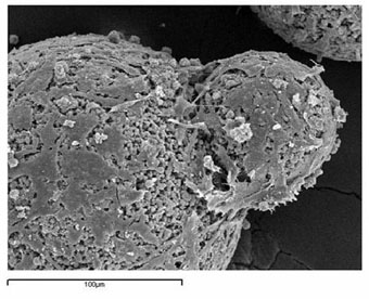 Bone like cells CPC