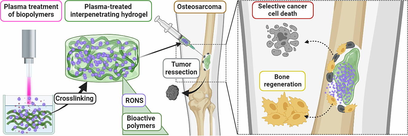 Engineering alginate-based injectable hydrogels combined with bioactive polymers for targeted plasma-derived oxidative stress delivery in osteosarcoma therapy.jpg