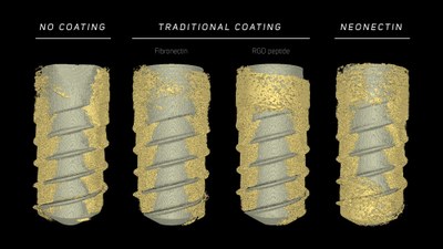 NeoNectinas, o cómo ayudar a tu cuerpo a curarse de manera natural